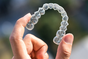 Someone holding a clear aligner 